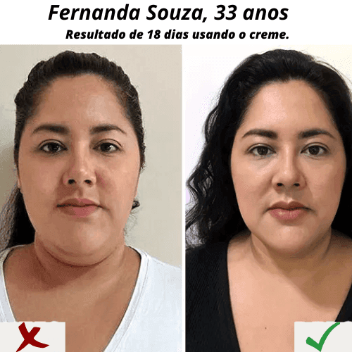 CreamMAX - XÔ PAPADA E REJUVENESCEDOR - RESULTADOS NO PRIMEIRO USO + BRINDE CLAREADOR - Minha loja