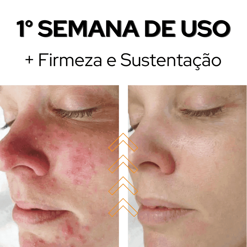 Sérum ESSENCE - XÔ MELASMA E MANCHAS - RESULTADOS NO PRIMEIRO USO + BRINDE EXCLUSIVO - Minha loja